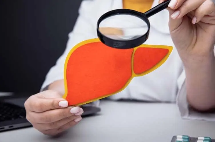 higado-graso-medico-internista-en-benito-juarez-cdmx